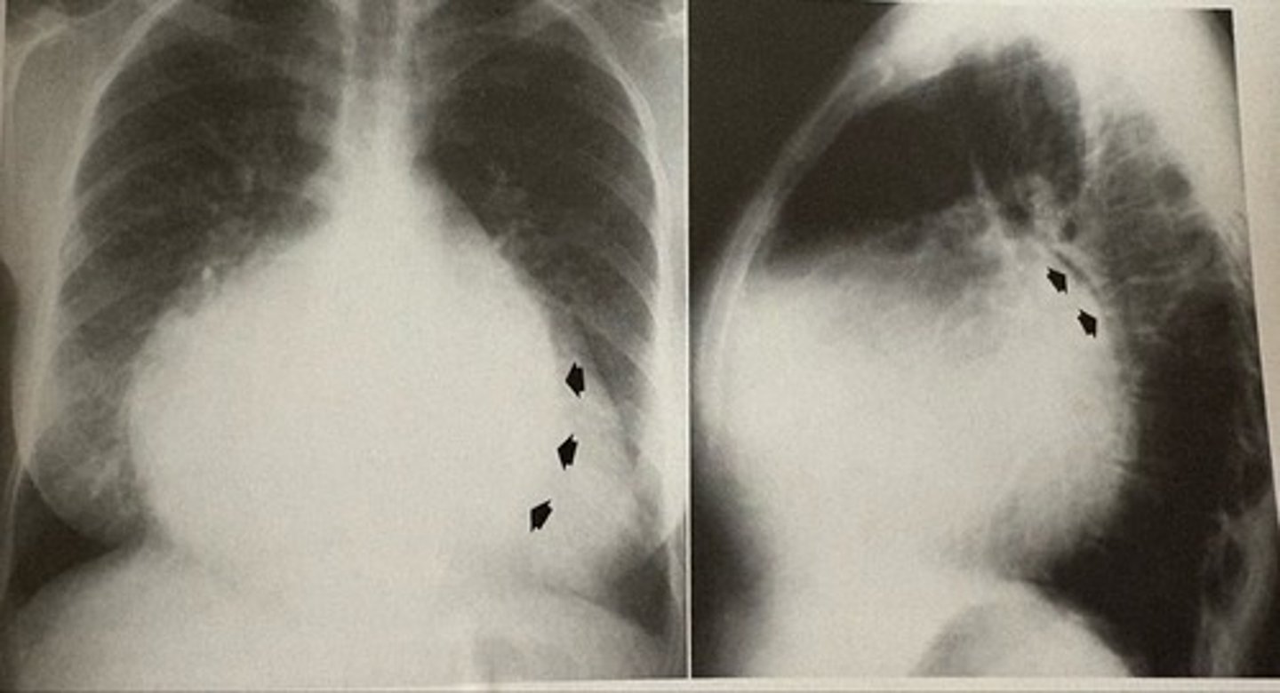 <p>what pathology is present?</p>