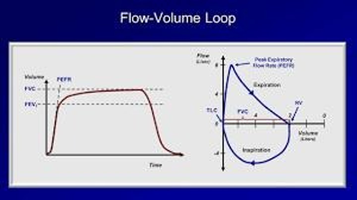 <p>It visually represents the results of the spirometry test, showing airflow and lung capacity.</p>