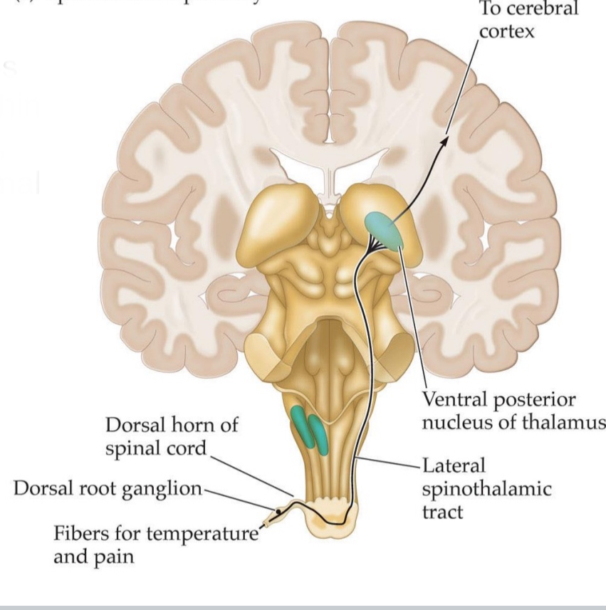 <ul><li><p>synapses multiple times within spinal cord: slow, nociception, thermal information</p></li></ul><ol><li><p><strong>Nociceptor in the periphery (e.g., finger)</strong></p><ul><li><p>Specialized&nbsp;<strong>free nerve endings</strong>&nbsp;(pain receptors) detect noxious stimuli (mechanical, thermal, or chemical).</p></li></ul></li><li><p><strong>Cell bodies of these sensory neurons</strong></p><ul><li><p>Located in the&nbsp;<strong>dorsal root ganglion (DRG)</strong>, which lies just&nbsp;<strong>outside the spinal cord</strong>.</p></li></ul></li><li><p><strong>Central axons of DRG neurons enter the spinal cord</strong></p><ul><li><p>They synapse in the&nbsp;<strong>dorsal horn</strong>&nbsp;of the spinal cord</p></li></ul></li><li><p><strong>Second-order neurons</strong></p><ul><li><p>Cross to the&nbsp;<strong>contralateral side</strong>&nbsp;of the spinal cord and ascend via the&nbsp;<strong>lateral spinothalamic tract</strong>, carrying pain and temperature information up through the brainstem.</p></li></ul></li><li><p><strong>Third-order neurons</strong></p><ul><li><p>These second-order neurons synapse in the&nbsp;<strong>ventral posterior nucleus of the thalamus (VP nucleus)</strong></p></li></ul></li></ol><ul><li><p>slow pathway because of so many synapses</p></li></ul><p></p>