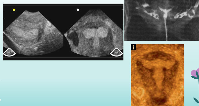 <p>what uterine anomaly is this?</p>