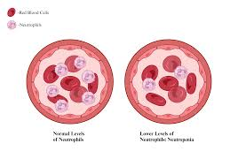 <ol><li><p>Antibacterial therapy </p></li><li><p>If patient is high risk or not responding to antibacterial therapy → add empiric coverage for candida </p></li><li><p>Other high risk:</p><ol><li><p>High dose corticosteroids, immunocompromised, HIV </p></li></ol></li></ol><p></p>