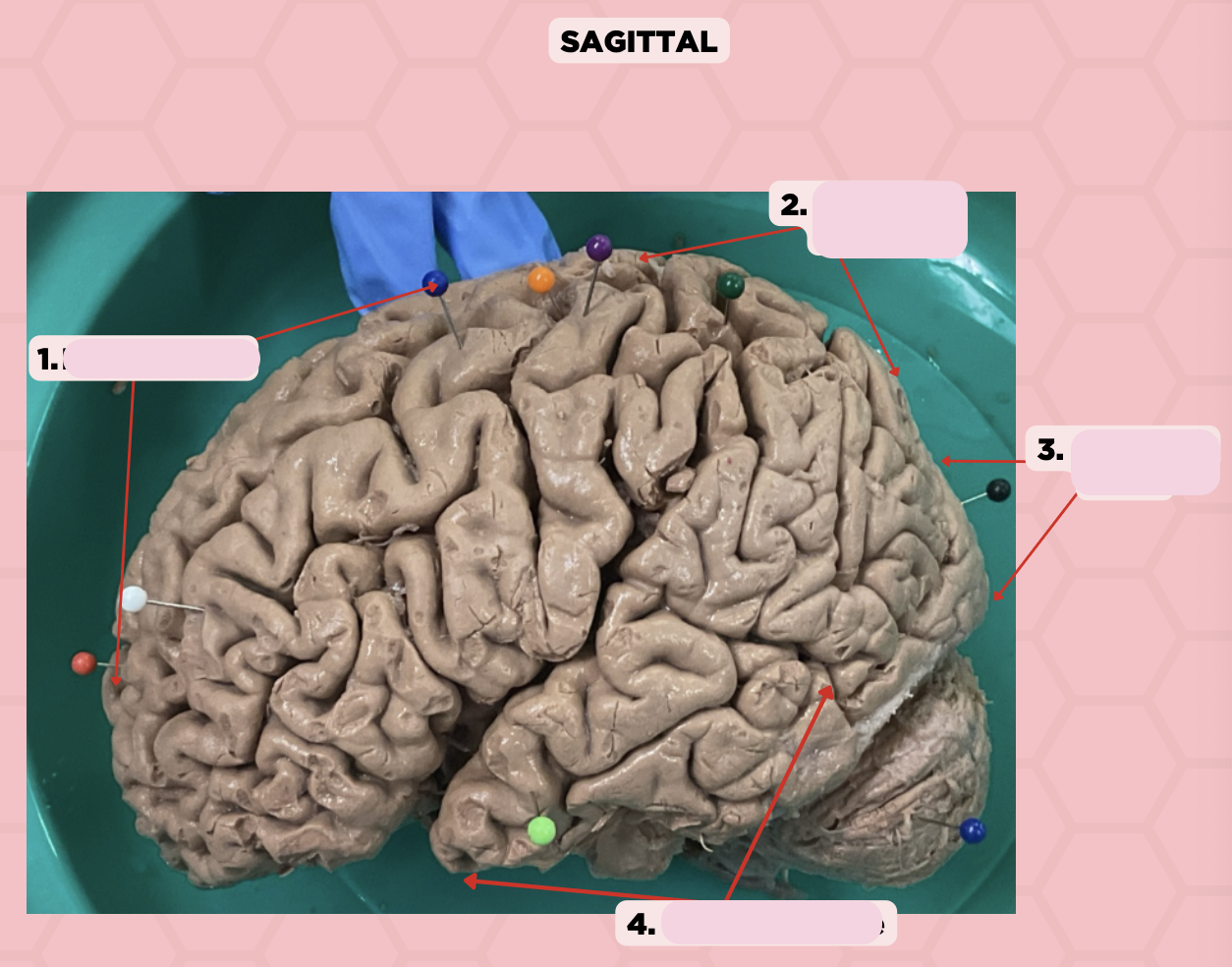 <p>Identify the structure labeled as 2.</p>