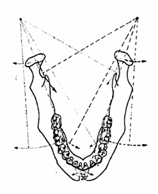 <p>The angle formed between the sagittal plane and the average path of the advancing condyle as viewed in the horizontal plane during lateral mandibular movements</p>