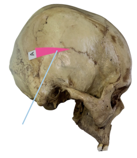 <p>Identify the suture labeled as A.</p>