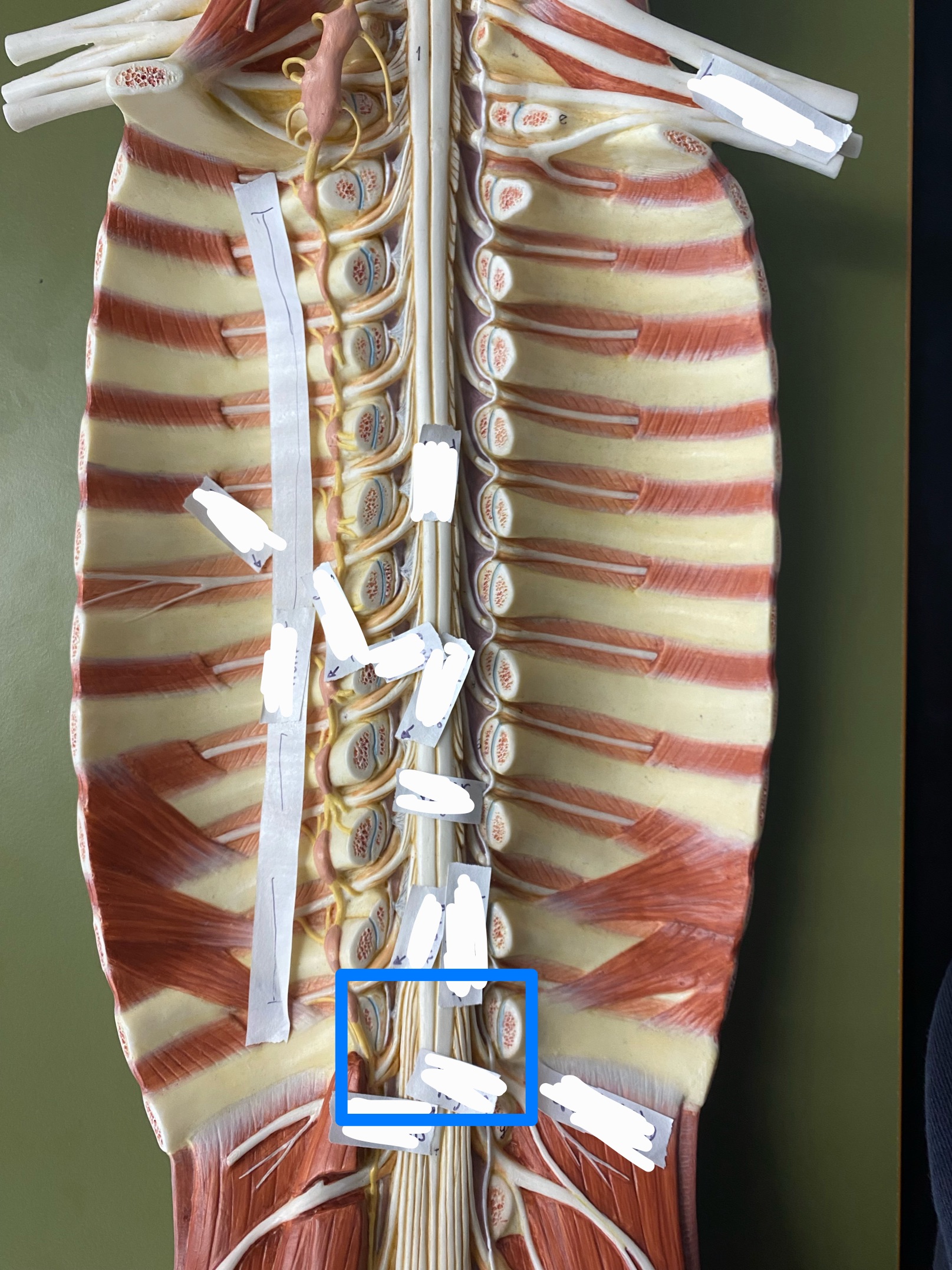 <p>ID plexus</p>