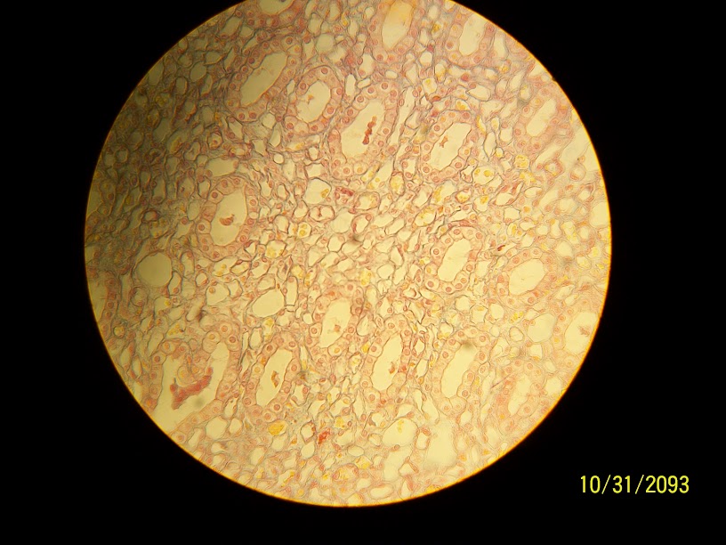 <p>Simple Cuboidal Epithelium</p>