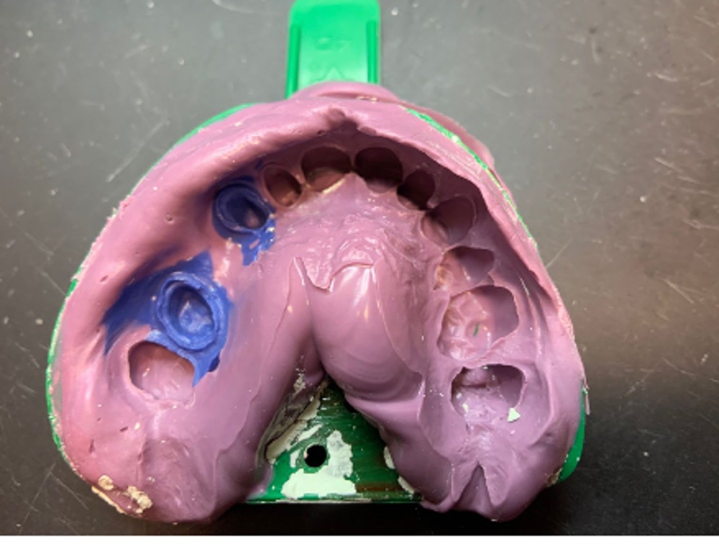 <p>What type of impression material?</p>