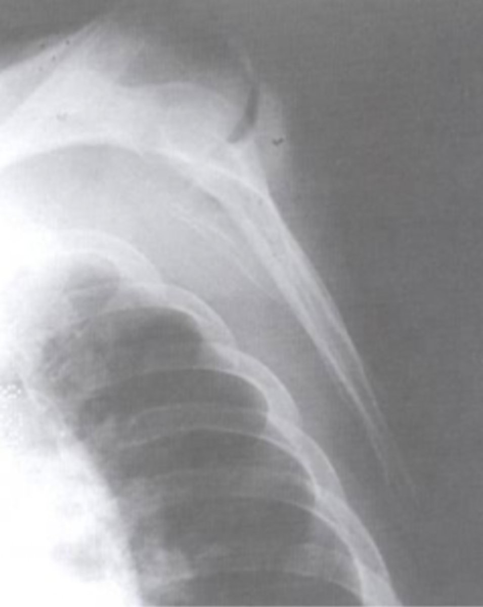 <p>What view is this?</p>