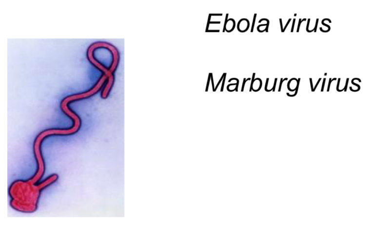<p>-Helical capsid</p><p>-Envelope </p><p>-Filamentous&nbsp;</p><p>-Up to 1000nm length&nbsp;</p><p>-Virion transcriptase&nbsp;</p><p></p><p>Cause:</p><p>-Ebola hemorrhagic fever (ebola virus)</p>