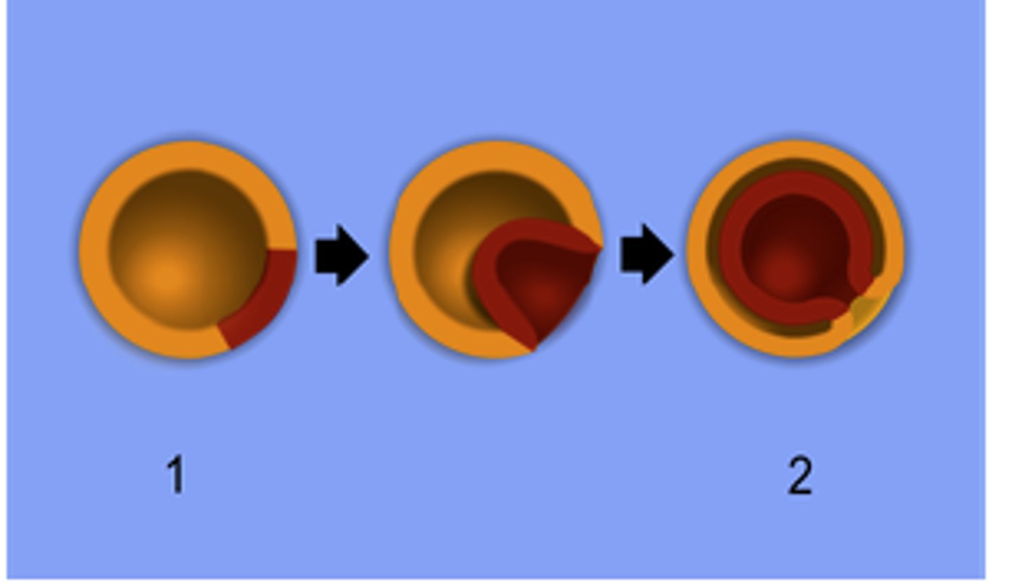 <p>Cells growing inward (invagination) to form the gut.</p>