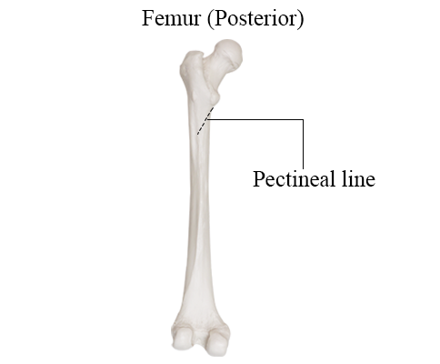 <p>Ridge on the proximal femur just below the lesser trochanter; attachment for the pectineus.</p>