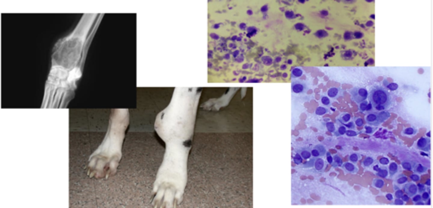 <p>What kind os neoplastic tumor are these characteristic of ?</p>