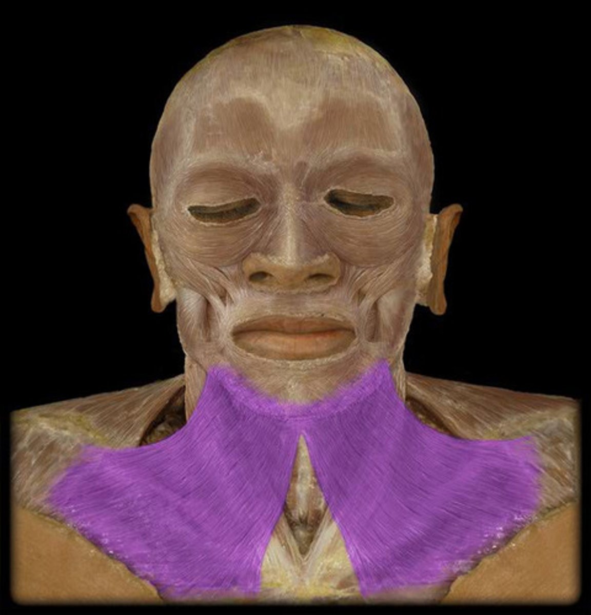 <p>mandible, bends with muscles around angle of mouth, and skin of lower face</p>