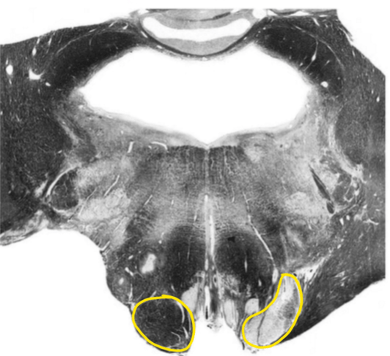 <p>ID the structure</p>