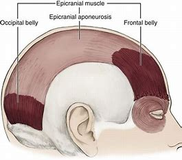 <p>Origin: Occipital and temporal bones</p><p>Insertion: epicranial aponeurosis </p><p>Function: fixes aponeurosis and pulls scalp posteriorly</p><p></p>