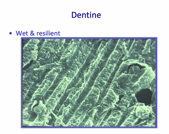 <ul><li><p>wet + resilient&nbsp;</p></li><li><p>consists of tubules that are approximately a <strong>micron </strong>in diameter - surrounded by <strong>intratubular </strong>dentine - which is a composite of collagen - covered with <strong><em>small crystallites of hydroxyapatite&nbsp;</em></strong></p></li><li><p><em>bonding to this tissue has always been a challenge&nbsp;</em></p></li></ul><p></p>