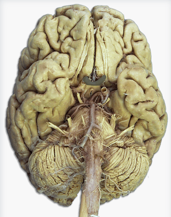 <p>Label this cranial nerve</p>