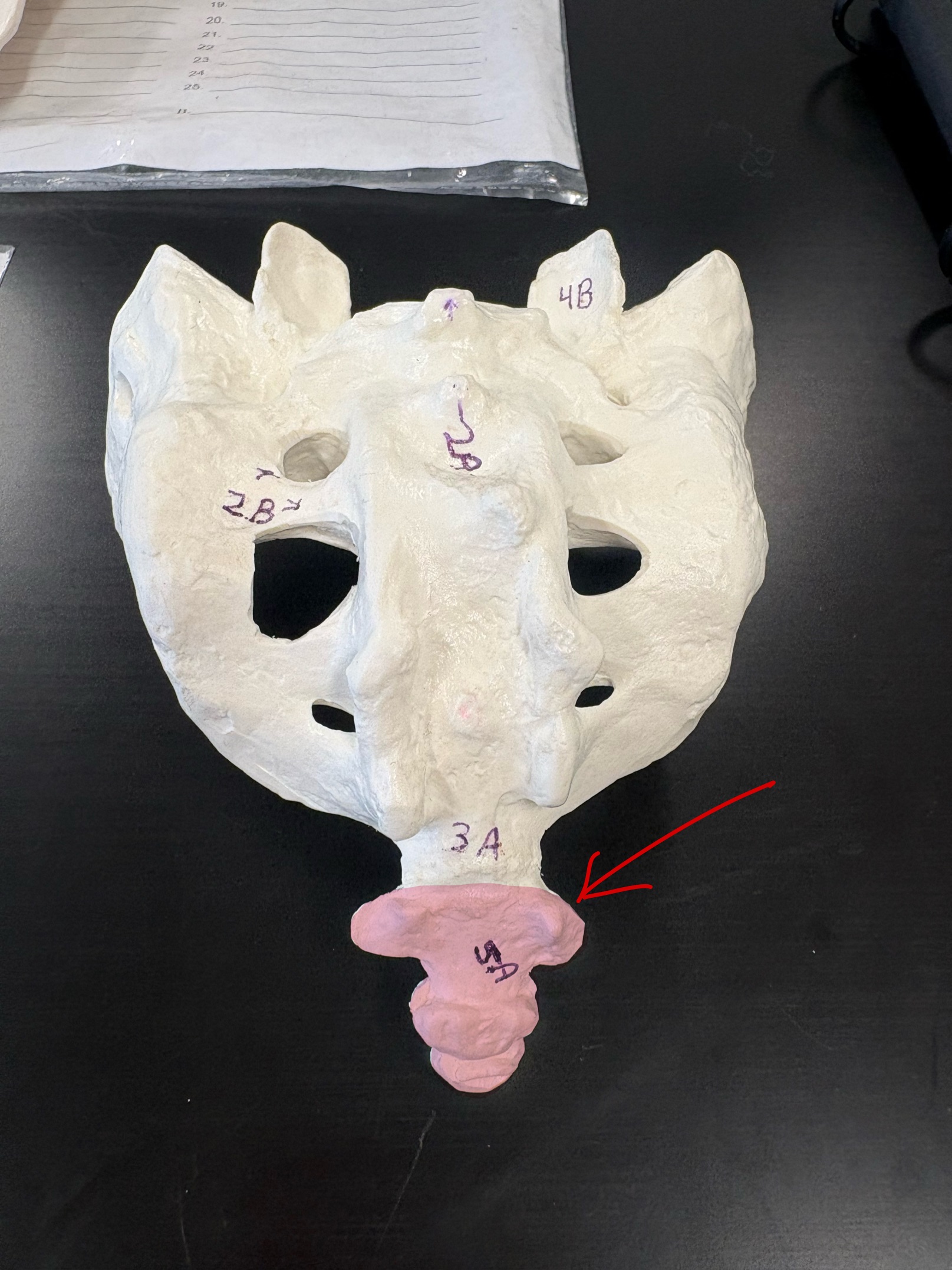 <p>Name this bone</p>