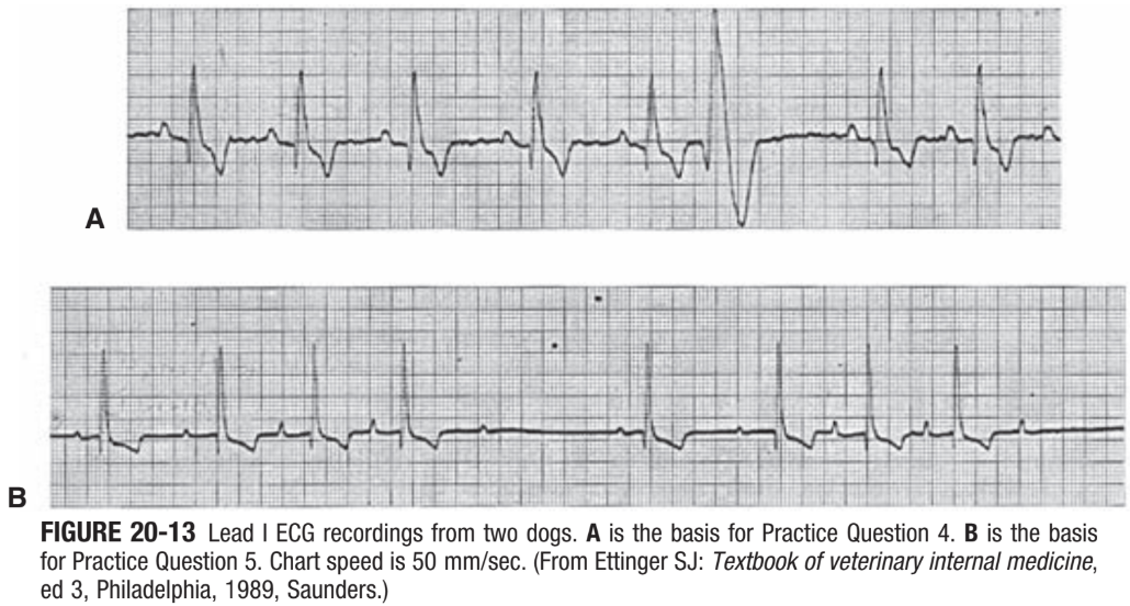 <p>CH 20, Q5: the ECG in Figure 20-13, B, indicates:</p><p>a. second-degree AV block</p><p>b. third-degree AV block</p><p>c. sinus bradycardia</p><p>d. ventricular tachycardia</p><p>e. ST segment elevation</p>