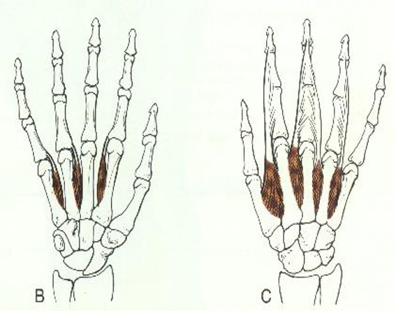 <p>-MCP joints</p><ul><li><p>Dorsal interossei</p><ul><li><p>ABD</p></li></ul></li><li><p>Palmar interossei</p><ul><li><p>ADD</p></li></ul></li></ul>