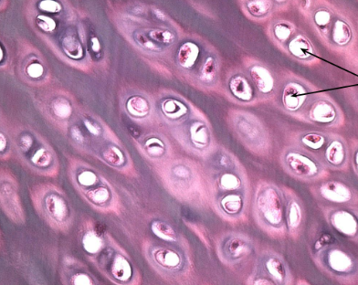 <p>Hyaline cartilage</p>