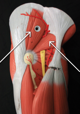 <p>arrow on left </p>