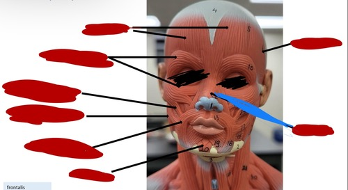 <p>What muscle is this?</p>