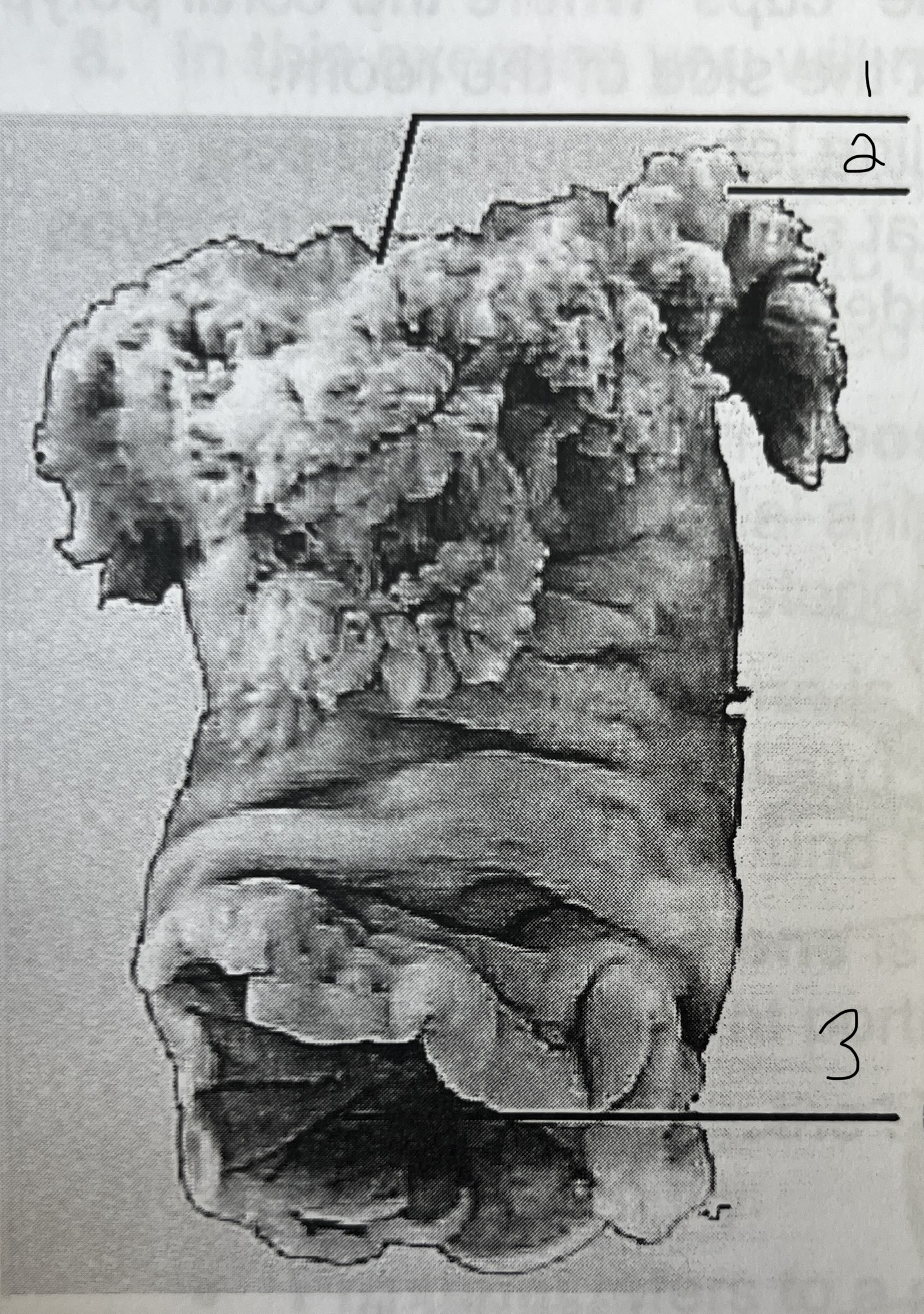 1 Metridium (Anenomes class anthozoa, phylum cnidaria)