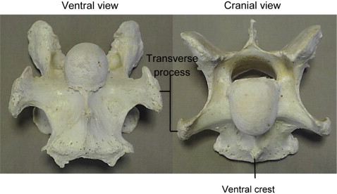 <p>Larger vertebral arch, small dorsal and transverse spinous processes, larger articular processes</p>