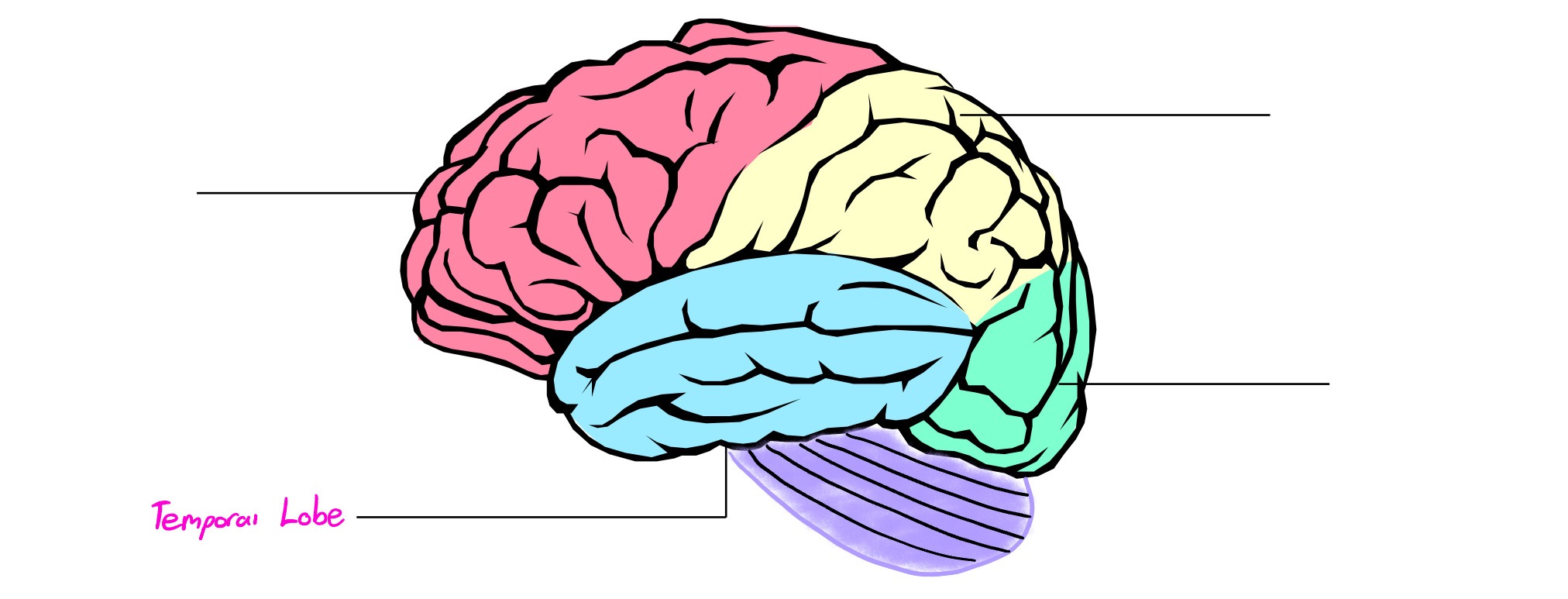 <p>Lobe of cerebral cortex; deals in hearing, memory</p>