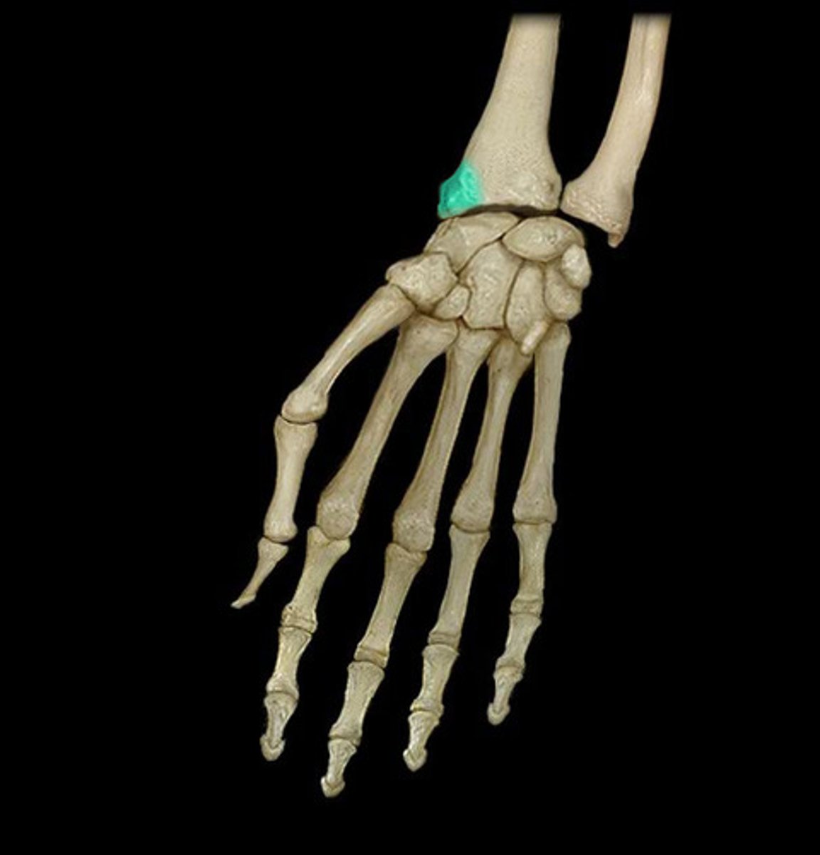 <p>lateral side proximal to thumb</p>