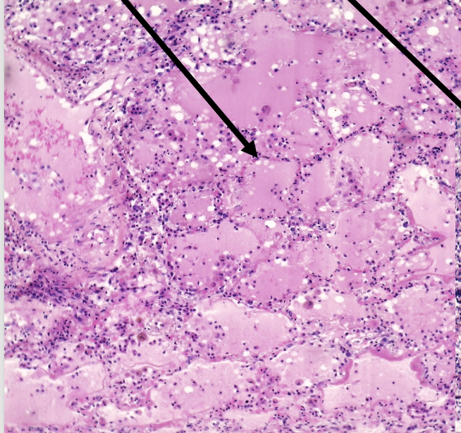 <p>wat duid de pijl aan</p>