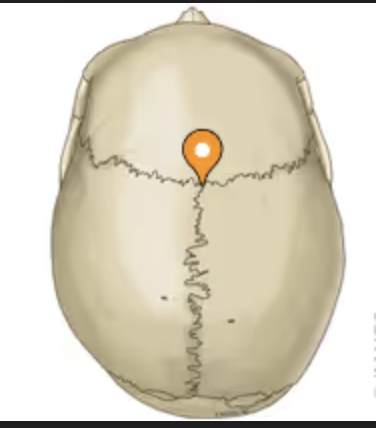 <p>Where the coronal and sagittal meet</p>
