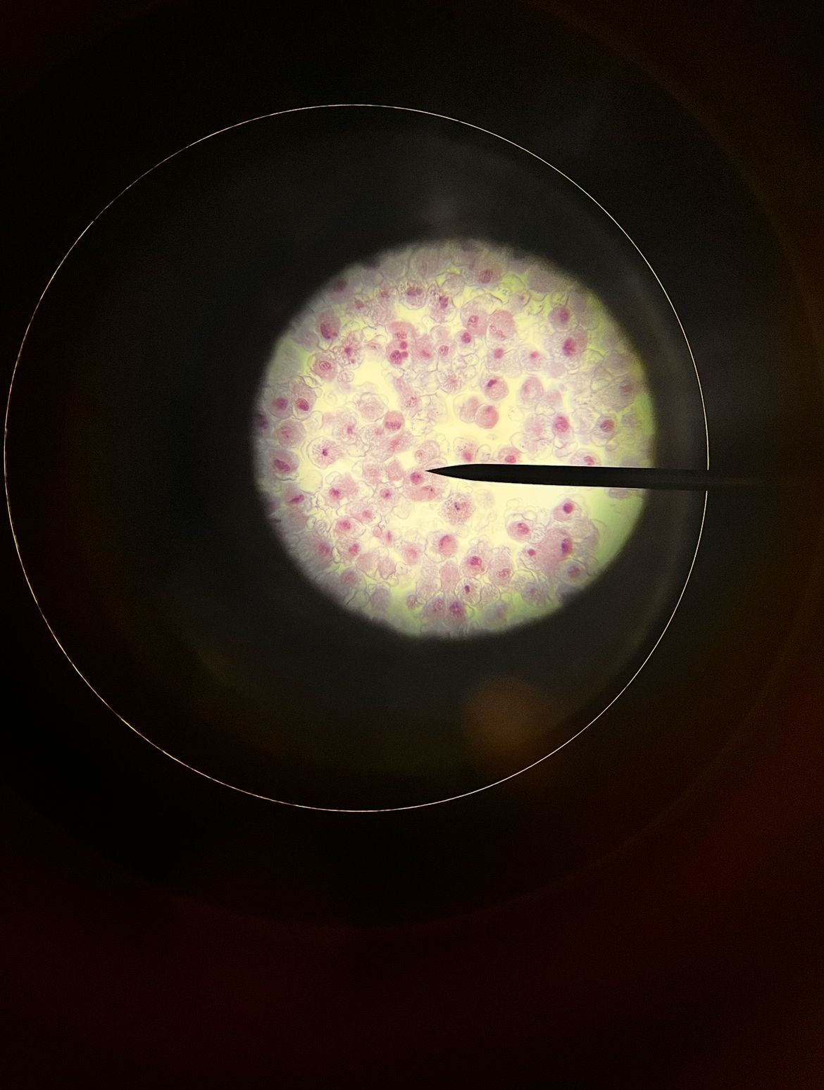 <p>Interphase </p><p>Chromatin </p>