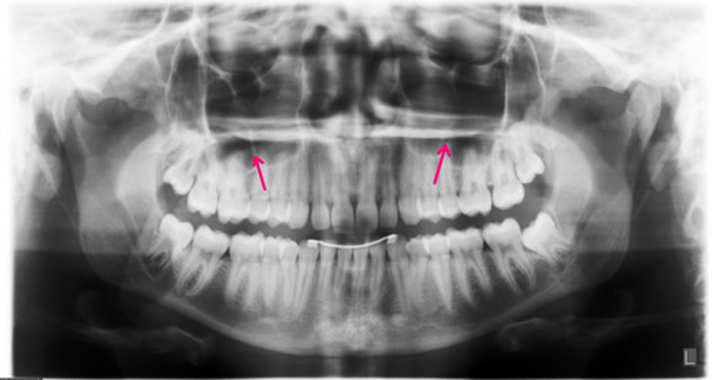 <p>Identify the structure.</p>