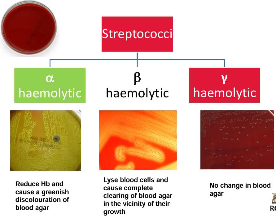 <p>many different streptococci - useful to classify them to aid identification of them</p><p>most commonly used classification systems:</p><ul><li><p>based on their on blood-containing agar (hemolysis)</p></li><li><p>based on antigens contained in their cell walls (Lancefield classification)</p></li><li><p>molecular classification (newer) - based on emm gene</p></li><li><p>some clinically important streptococci often referred to by both Lancefield group and hemolysis pattern</p></li></ul><p></p>