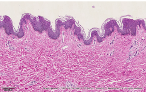 <ul><li><p>the skin</p></li><li><p>layers: epidermis, dermis, and subcutaneous layer/hypodermis</p></li></ul><p></p>
