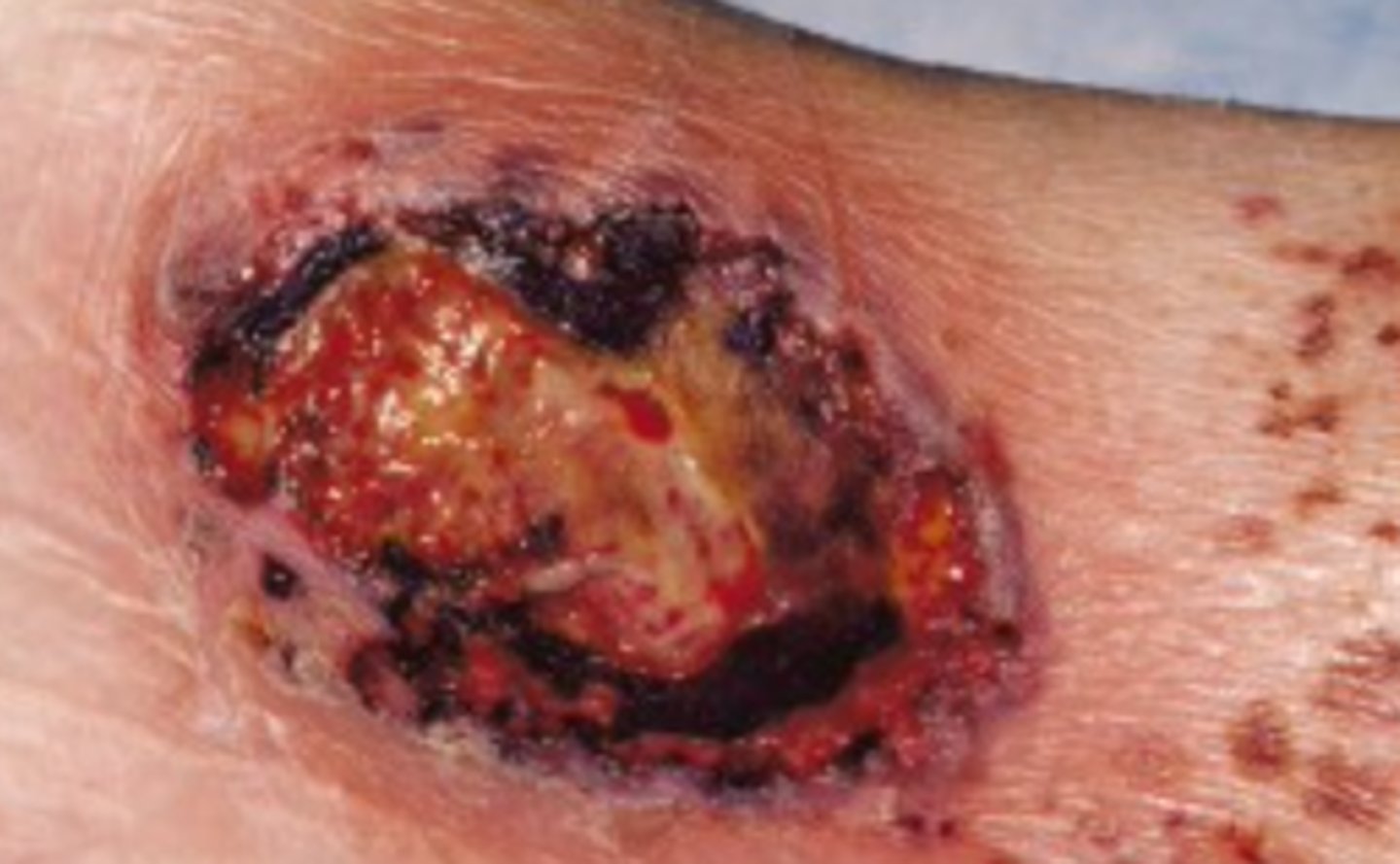 <p>What is the diagnosis?</p>
