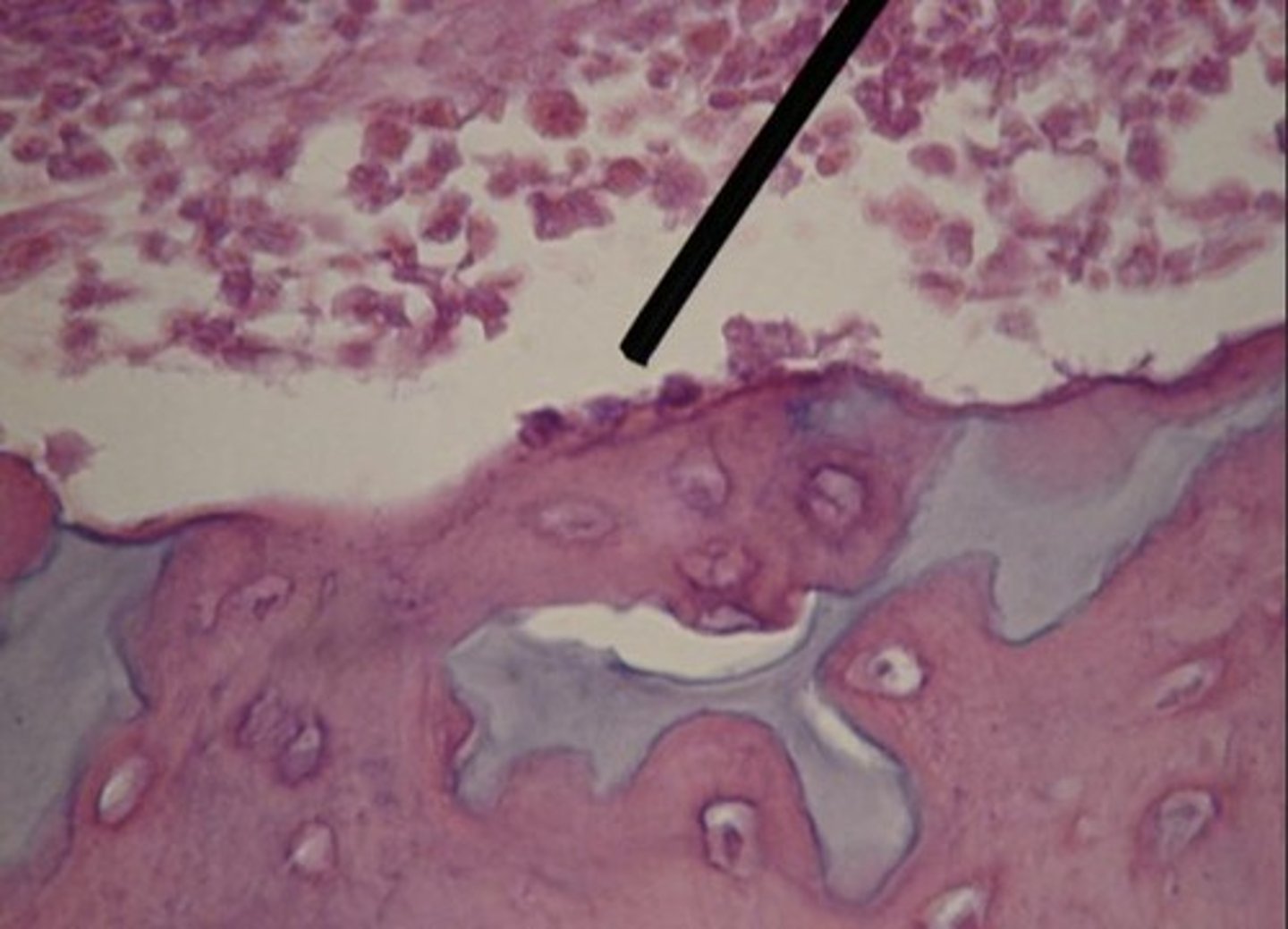 <p>Maintenance cells managing bone matrix.</p>