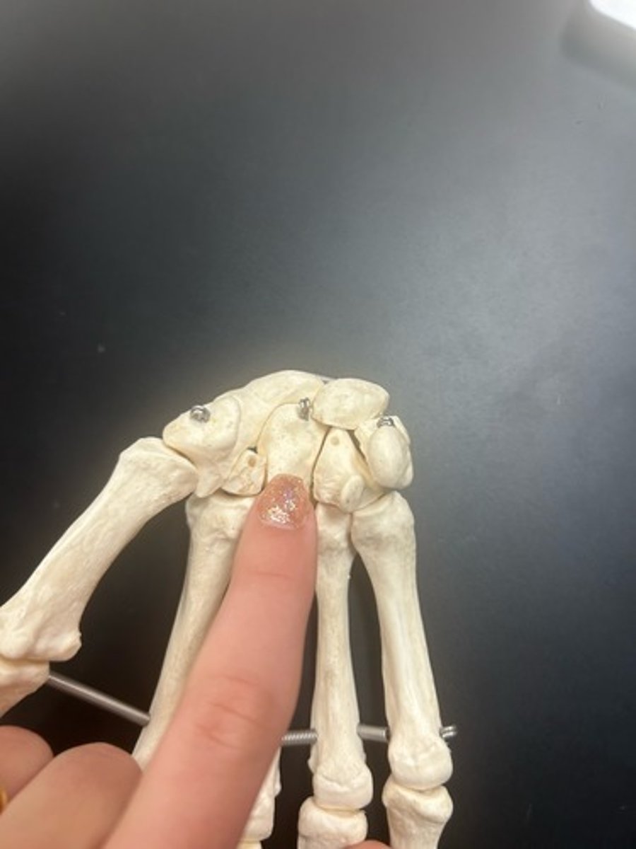 <p>name the bone</p>