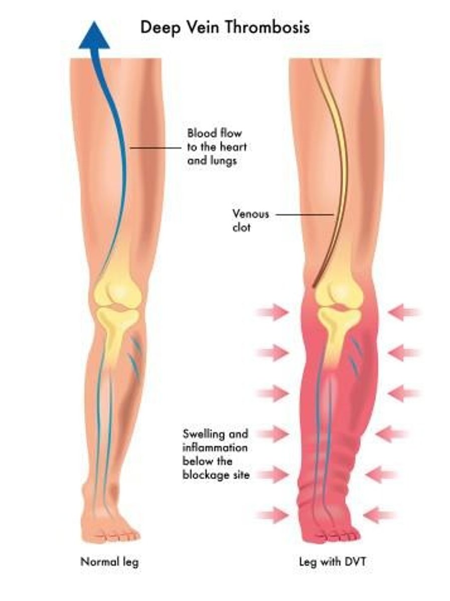 <p>Never rub calves or thighs.</p>