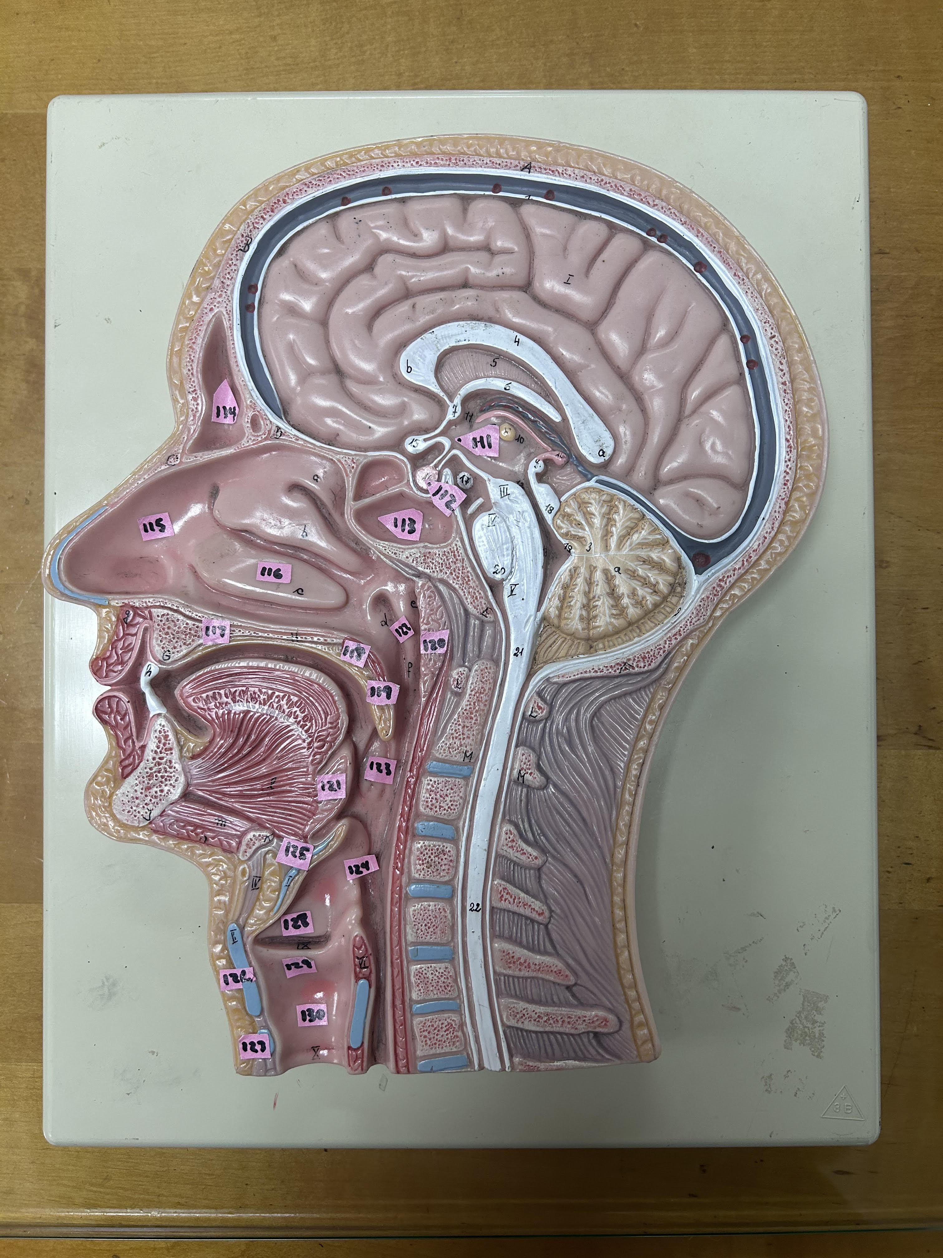 <p>Label 113</p>