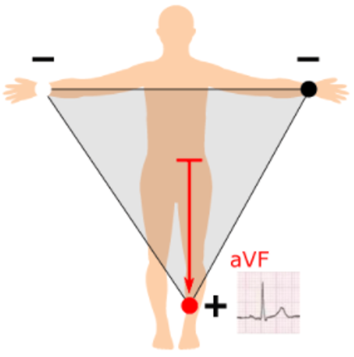 <p>From halfway between the left arm and right arm to the left leg with the positive electrode being at the left leg, at 90°</p>