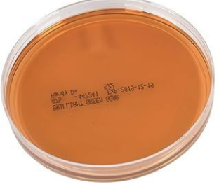 <p>Identifica el siguiente medio (rojo obscuro traslucido) de cultivo, su inhibidor, su indicador y su aplicación</p>
