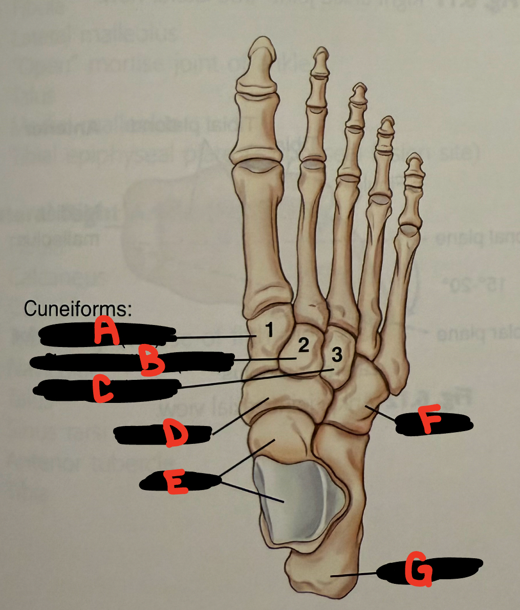 <p>A</p>