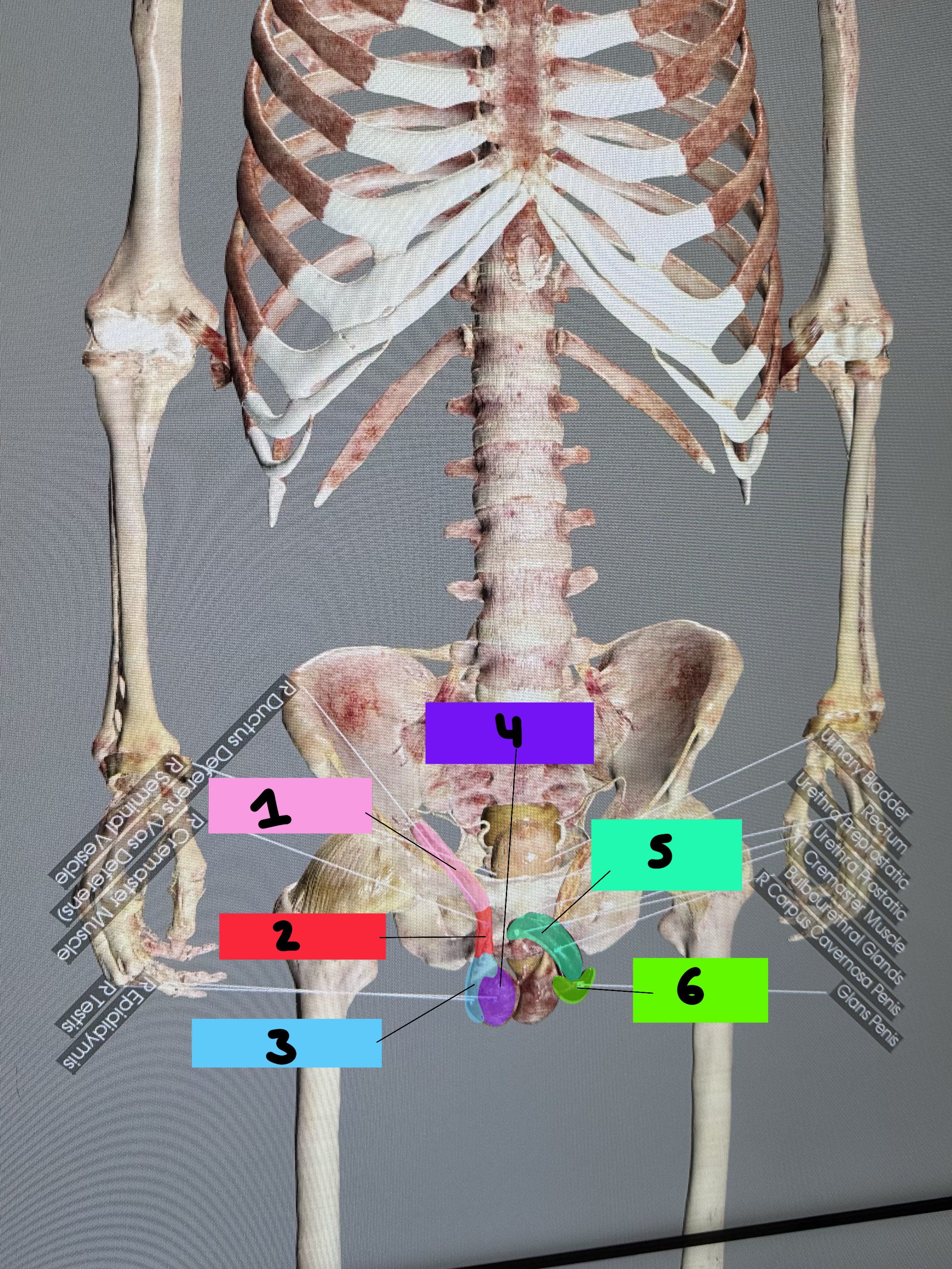 <p>Viktor Reproductive Cadaver: 6 </p>