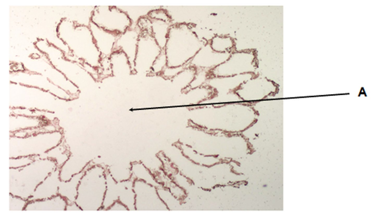 <p>large central cavity of the sponge</p>