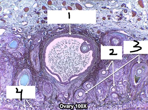 <p>1 ovary</p>