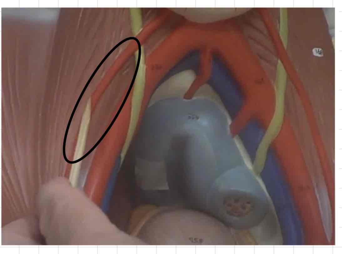 <p>what is this? (torso model)</p>
