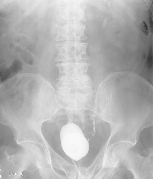 <p>what is the pathology</p>